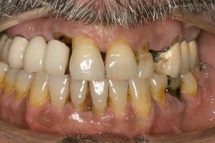 Before-